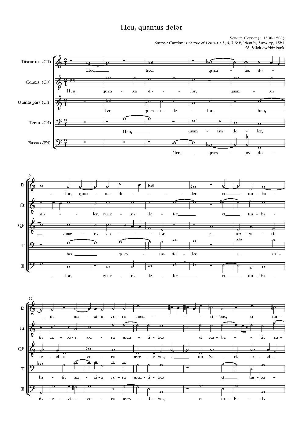 Heu, quantus dolor - Choir Script PDF Thumbnail